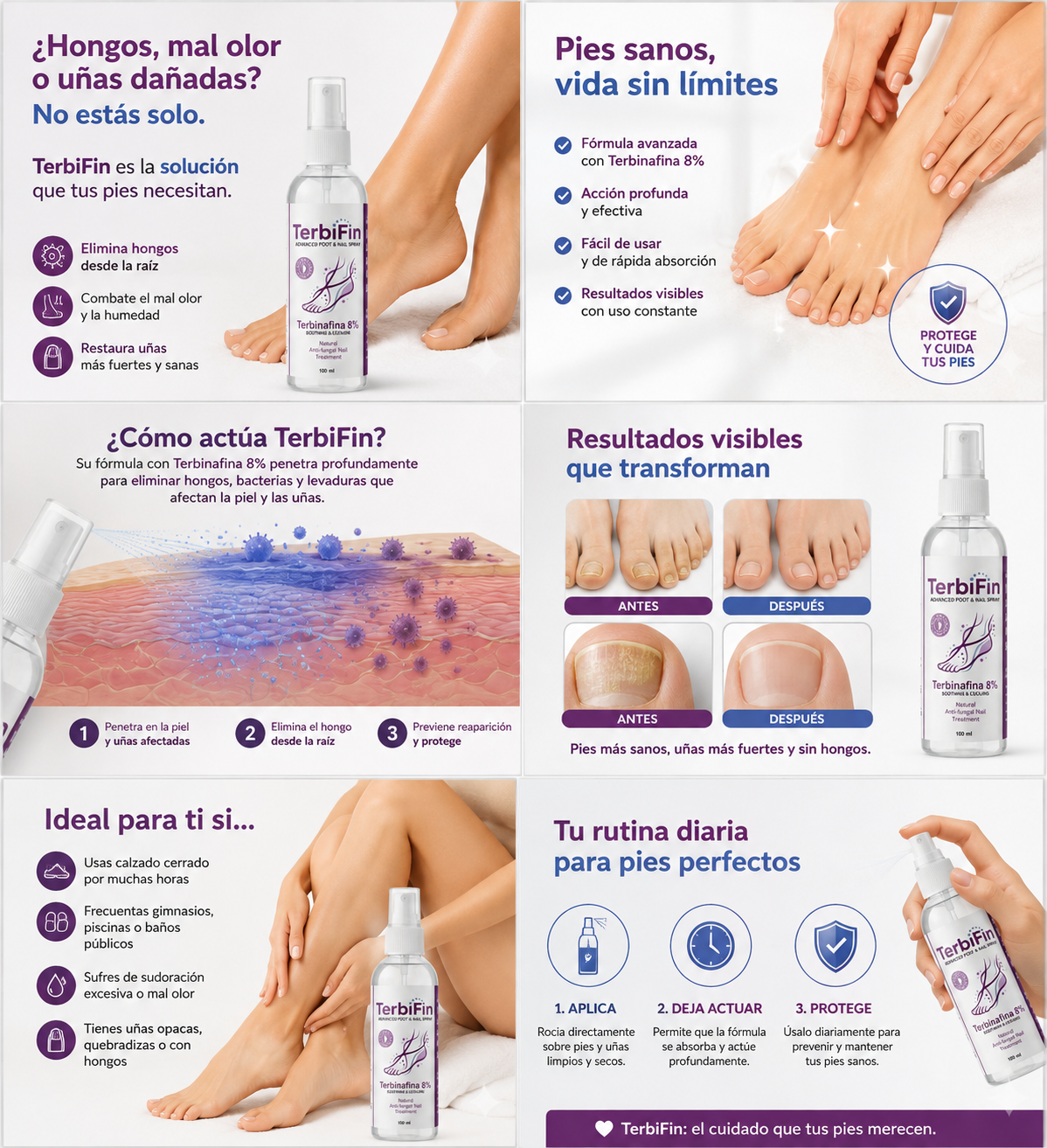 TerbiFin Spray 8% Anti-Hongos